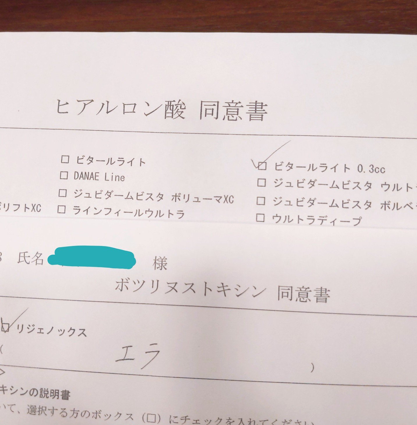 湘南美容外科 友人紹介割 Sbc 脱毛 埋没 涙袋のヒアルロン酸 今日は湘南美容外科で涙袋のヒアルロン酸と エラボトックスをしました ヒアル ビタールライト0 3cc 18 330円 マイクロカニューレ 6 090円 エラボト リジェノックス 8 800円 計3万円を