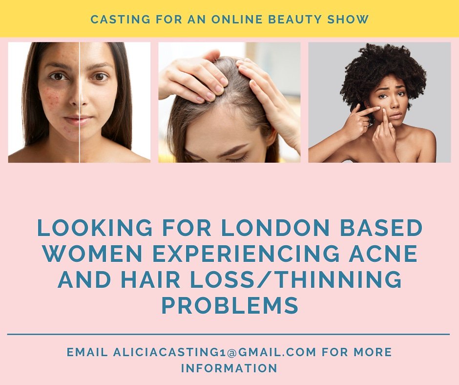 Is your hairline thinning or are you starting to experience #hairloss. See my casting below for the chance to feature in an online beauty show and receive advice #tvcasting #Londoncasting #lastminutecasting