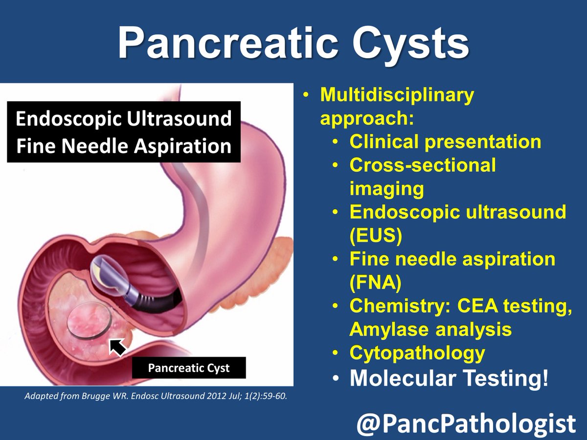 14/n Note, PancreaSeq has been used to help classify and stratify  #PancreaticCysts from >2000 patients. And BiliSeq has been used to evaluate >400 bile duct strictures and identify actionable targets for patients with  #Cholangiocarcinoma  @UPMCnews