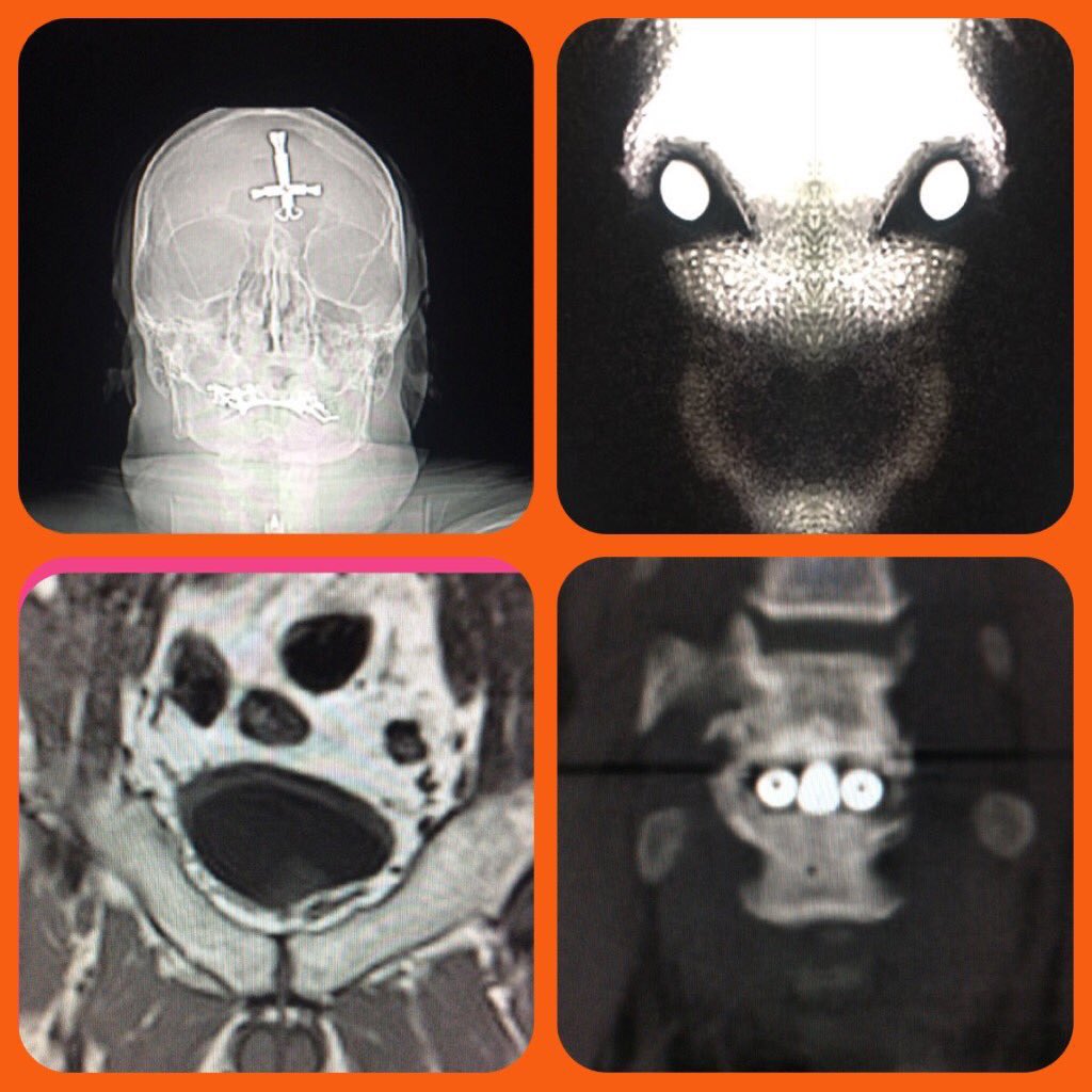 Happy radiology Halloween!