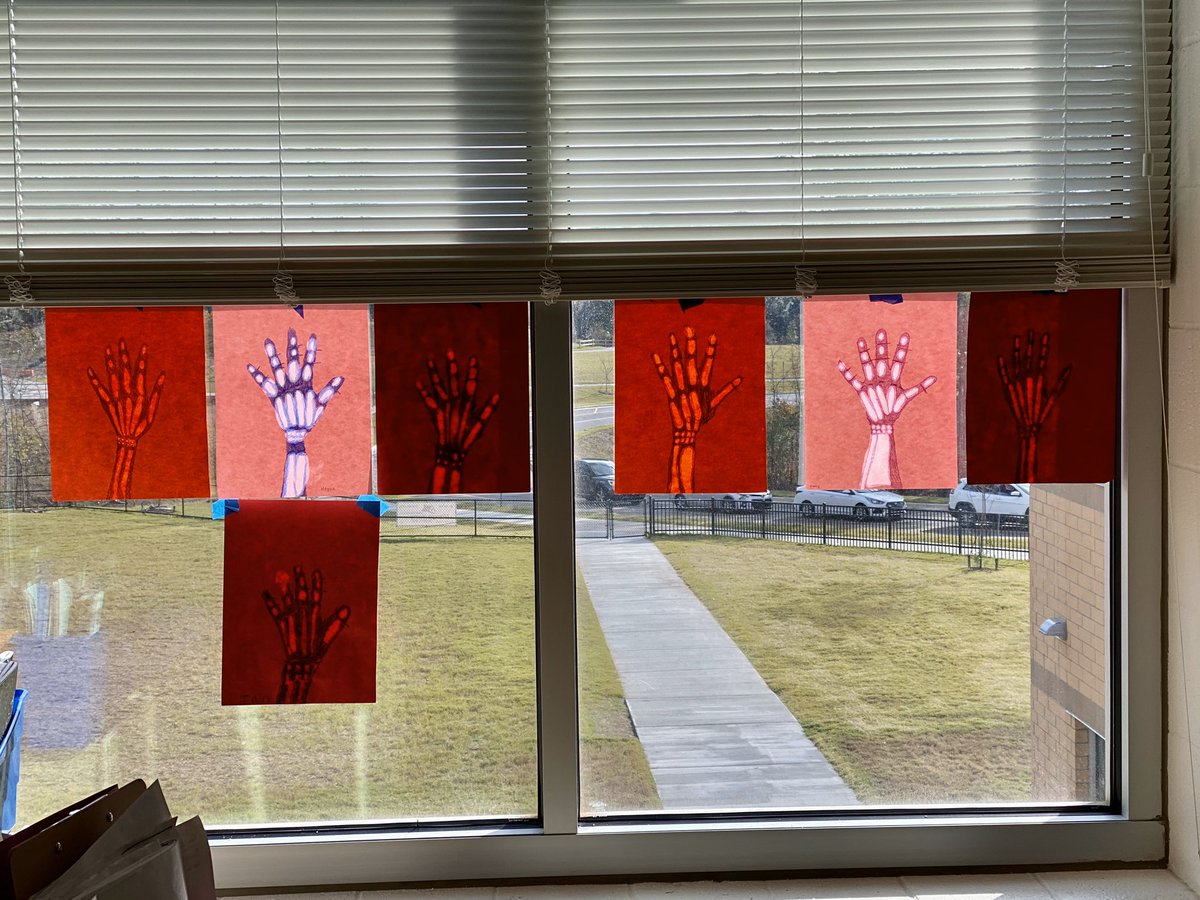 Loved this mystery science lesson where we made x rays of our hands and lower arms as we learn about the human body in science!