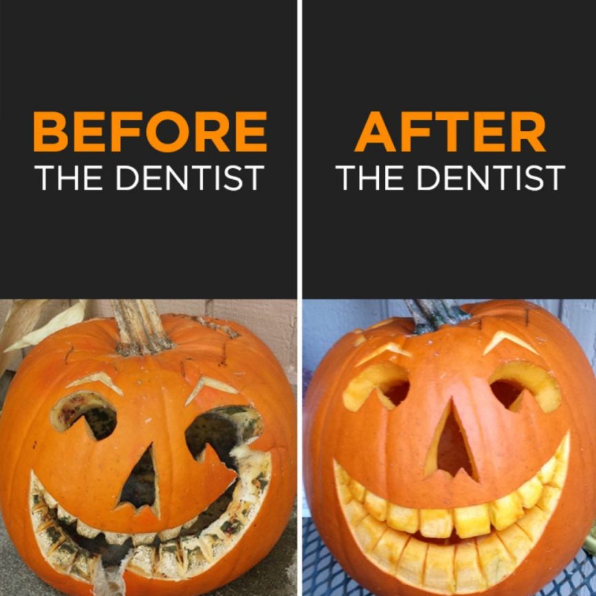 SimplySmilesMia's tweet photo. Happy Halloween!  Check out one of our most recent patient's Before &amp; After pics! 😉😂

305.235.9321 for appointments.
New patients welcome! 😀
https://t.co/VGIQOn9feM
#dentist
#pinecrestdentist
#miamidentist
#dentistnearme
#dentalofficepinecrest
#halloween #candy https://t.co/vtwUuW8BLq