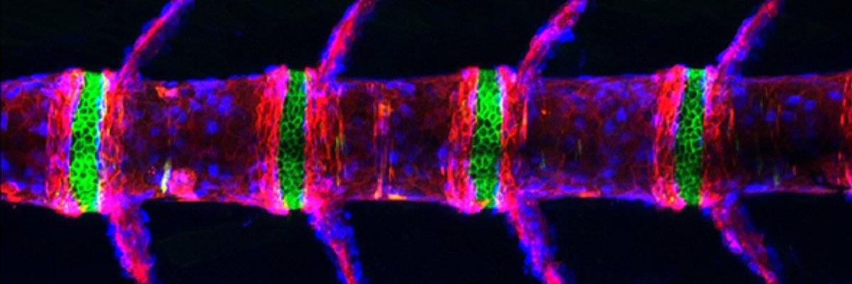 Planaria1's tweet photo. Michel Bagnat @BagnatLab @DukeU presents the penultimate talk of the meeting: «Phylogenetic identity of vertebral axis imparted by the notochord”
https://t.co/d0PZaVrUlD
@LASDB_DevBiol @___SDB___ #LASDB19 https://t.co/JgQTkWc27d