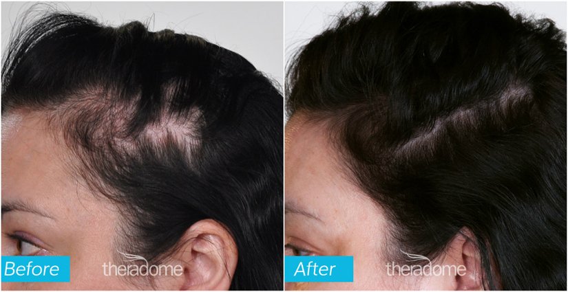 DrsAntiAging's tweet photo. It's a helmet with lasers that can help regrow each hair on your scalp up to 80% thicker. Wanna learn more? Click here ---> https://t.co/dLrimnXsq5 https://t.co/UUfFUWPYyK
