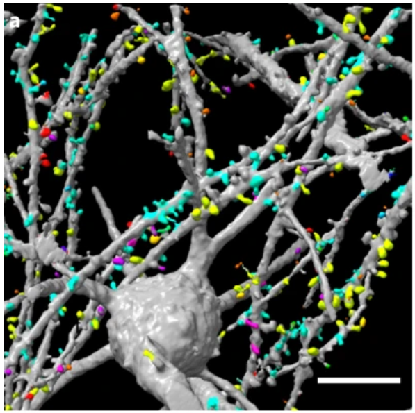 naturemethods's tweet photo. And with the November issue comes Cleared-tissue axially swept light-sheet microscopy (ctASLM) for high-speed, refraction index-independent imaging of live, cleared and expanded samples with isotropic, submicron resolution. https://t.co/NjFhKcAWGu https://t.co/zH3ihf8ZCl
