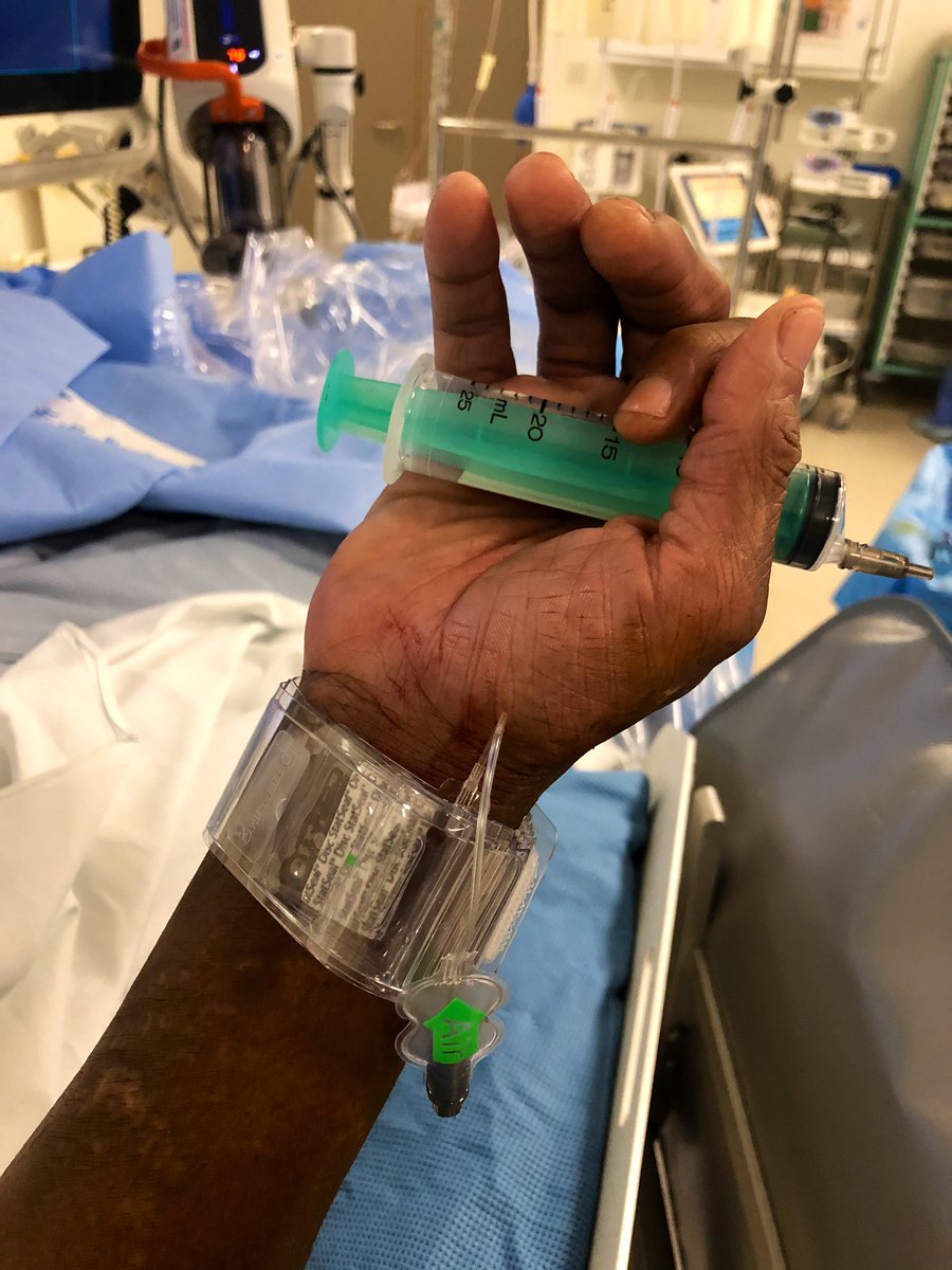 RLHINR's tweet photo. Celebrating our one year anniversary of a 7 day mechanical thrombectomy service @RoyalLondonHosp @NHSBartsHealth #leavenoELVObehind #onwardsandupwards #spectrumstroke #WorldStrokeDay https://t.co/i2cOqDyXwc