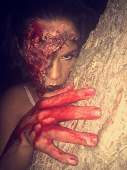 So my facial peel didn&rsquo;t go as expected... #ThrowbackThursday #HalloweensPast https://t.co/Bn0p23FE8<a href="/tag/throwbackthursday"class="tags">#ThrowbackThursday</a><a href="/tag/halloweenspast"class="tags"><span>#halloweenspast</span></a>