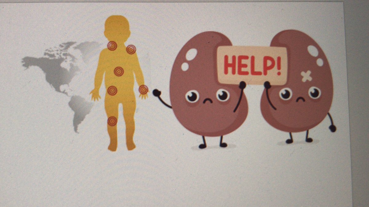 Excited about some R&amp;R! Our first revamped pediatric renal/rheumatology case conference at CHAM on the topic of ANCA vasculitis @TamarPedsRheum <a href="/NataliaVasCan/">Natalia Vasquez Canizares 🇨🇴</a>