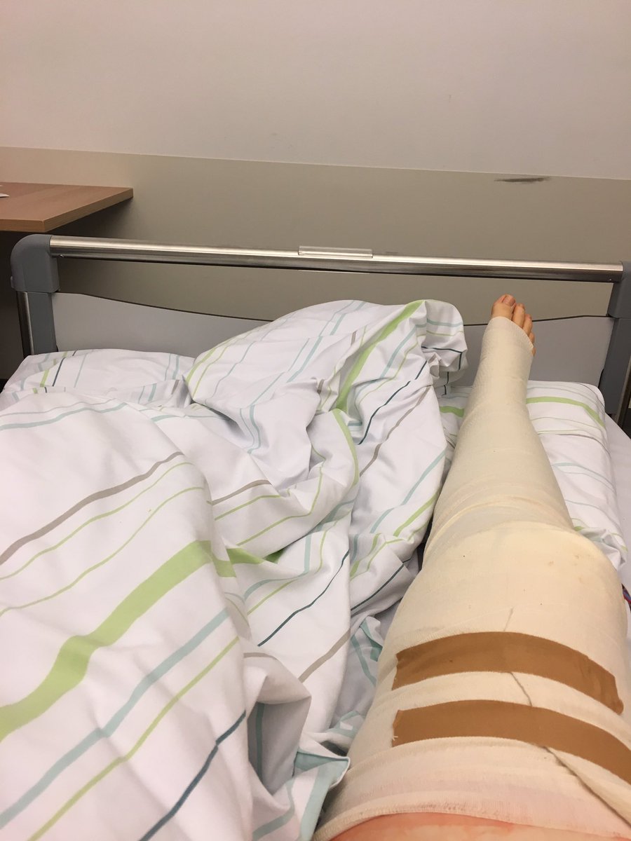 MelliCookie's tweet photo. @AnastaciaMusic Happy Halloween! 🎃
One of the perks of being operated on Halloween is that you‘re somewhat automatically going as a half wrapped mummy... 🧟‍♀️🤟🏻 https://t.co/Ihj4Vh2rmA