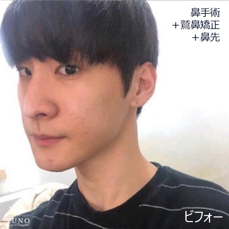 最も人気のある 鷲鼻 男 男 鷲鼻 かっこいい