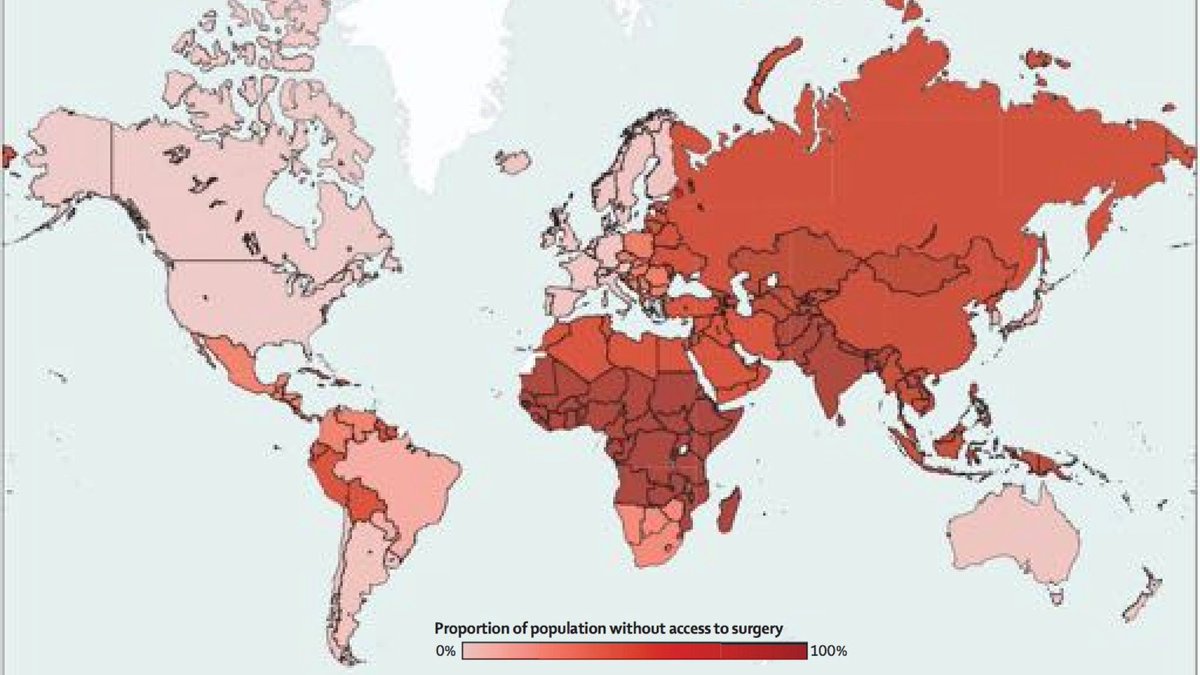 Access to #surgicalcare varies widely when stratified by region. Addressing this #Inequity is fundamental to achieving global health goals #GlobalSurgery