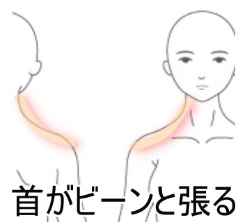 ツボネット 鍼灸院の症例が集まるツボ辞典 Auf Twitter 症例 途中覚醒を起こす首の違和感 本症例は仙腸関節の捻じれを整えることで寝返り動作の改善に繋げ 頚部の緊張を和らげたものであります 部分に囚われることなく どのような時に痛むのかを考えると最短の道