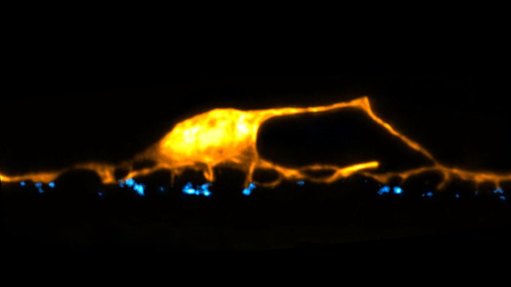 A skinny spider or an alien neuron? #SpookyScience #MicrosCreepy #AiryScan