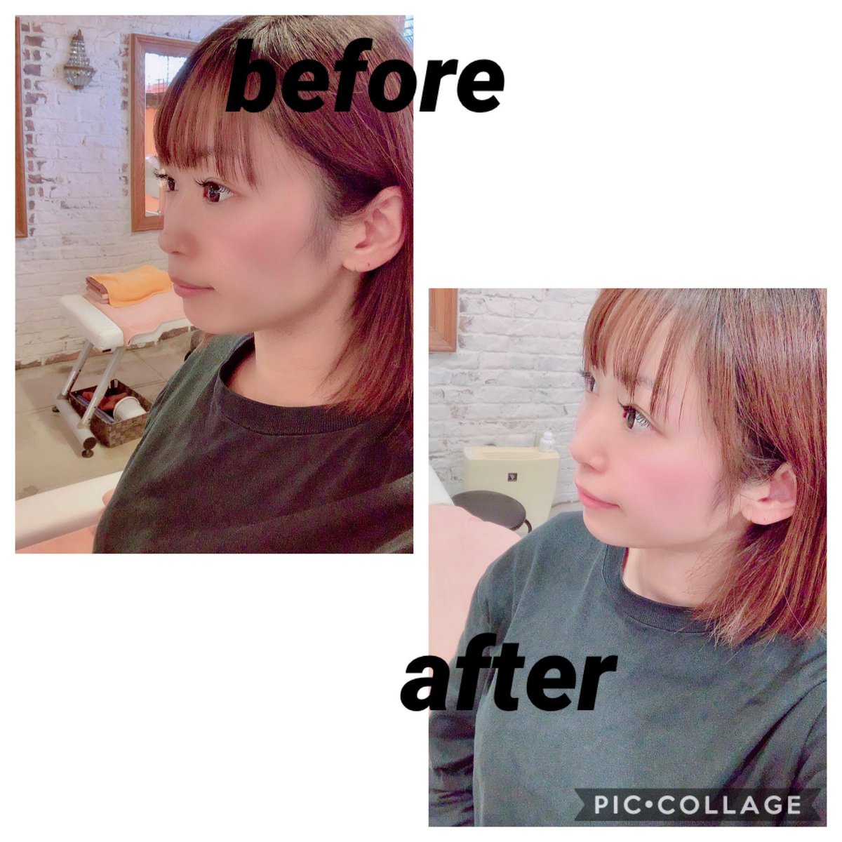 渋木美沙 Di Twitter 先日いつもお世話になってる 整体に久しぶりに 行って来ました 姿勢矯正と 小顔矯正もしてもらってきた 顎のラインがすごい変わって 目の大きさも劇的に変わり 整形並みwww ホントに魔法みたいでした 小顔になりたい方に おすすめ