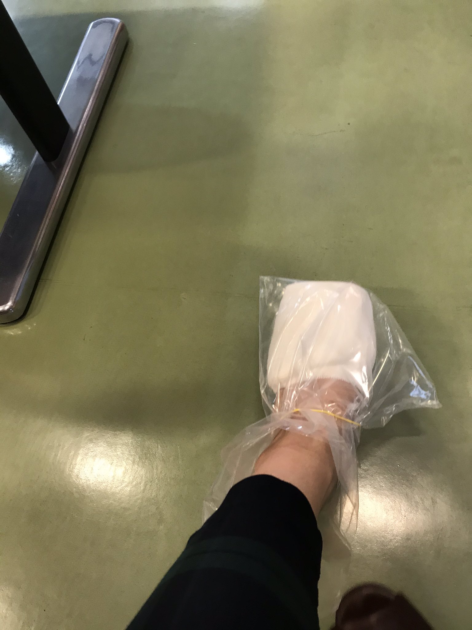 遠堂みなみ 先日ホテルでぶつけた左足の薬指ですが 変色はだいぶマシになったけど痛みが取れない ので 渋々整形外科を受診しましたら まさかの骨折でした 靴下も靴も履けないから 優しい看護師さんがはめてくれたビニール袋でノマド先の