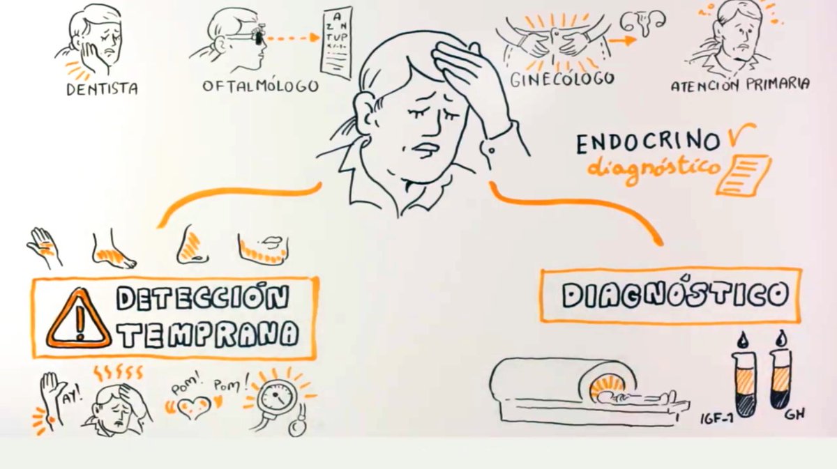 NoInvisibles's tweet image. Hoy es día mundial de la #Acromegalia
@Acromegalia_Esp ha preparado esta #infografia en la q se incluyen los #síntomas para darla a conocer.
¿Nos ayudas a compartir?👉Detección Temprana.
#MyAcroLife  #WorldAcromegalyDay
Y con @pfizer_spain este vídeo👇

youtu.be/44J40N1F0Z4