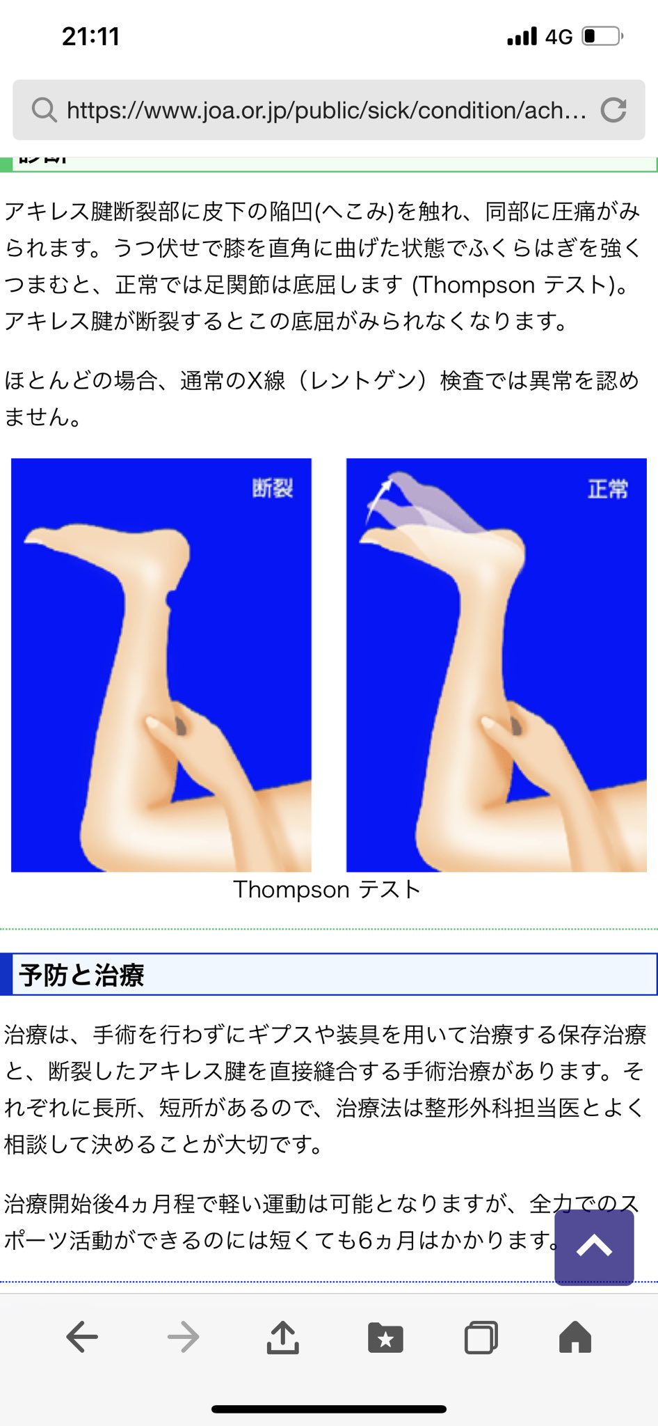 Hiro 子供達とはしゃぎ過ぎてアキレス腱断裂しました 最低でも2ヶ月は運転出来ない 会社の皆さんごめんなさい Hiro 子供達とはしゃぎ過ぎてアキレス腱断裂しました 最低でも2ヶ月は運転出来ない 会社の皆さんごめんなさい