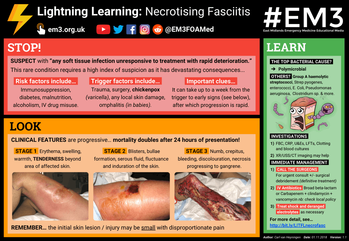Looking for a refresher on how to spot the signs and symptoms of Necrotising Fasciitis? We have a handy #LightningLearning that covers it, along with the relevant investigations and immediate management 👍