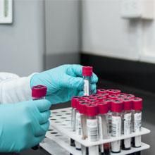 MSBProgram's tweet image. New assay alert: If you're interested in prion diseases, but are frustrated by the lack of methods to actually evaluate them, we are 100% with you. That's why this paper detailing a bacteria-based assay that detects prion formation is pretty exciting. buff.ly/2pwmBe2