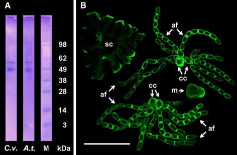 sci_plant's tweet photo. PIN2-like proteins may contribute to the regulation of morphogenetic processes during spermatogenesis in Chara vulgaris
https://t.co/OCm4N8Ryb7
#sciplant #plantscience #Spermatogenesis #Immunodetection @PlantCellRep ♻️ https://t.co/3gj3vDE6yG