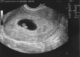 Our frist babie