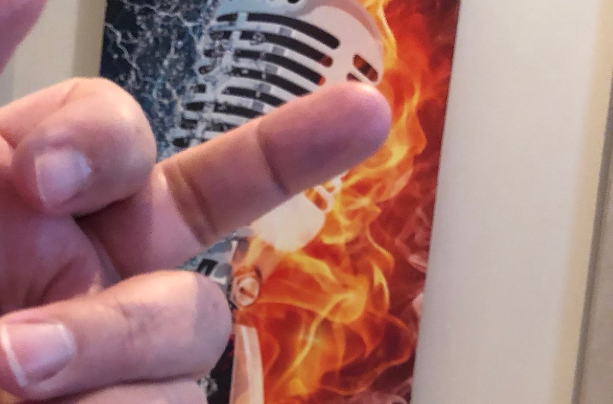Hand surgery today on my middle finger. This baby gonna be good as new 🤟