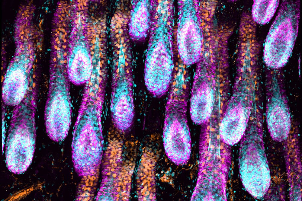 RockefellerUniv's tweet photo. To grow new hair, stem cells throughout the skin must work in sync. Researchers in the #FuchsLab have discovered the molecular communication tool, part of the lymphatic system, that the cells use to synchronize their activities.  #RockefellerScience https://t.co/rCS5XhLQHu https://t.co/xIyJ1m5Q0A
