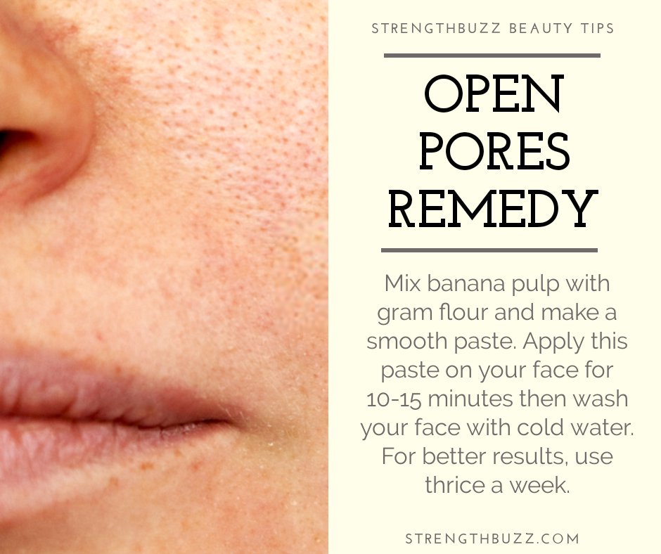 StrengthBuzz's tweet photo. How to get rid of open pores on your face? Follow the simple remedy.
.
.
#Beauty #BeautyTips #Face #FaceHacks #BeautyHacks #StrengthBuzz https://t.co/yfrMy0G95j
