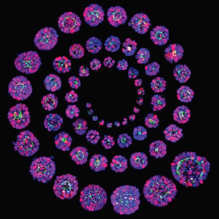 reNEW (@renew_global) on Twitter photo Congrats to our @UCPH_DanStem <a href="/UCPH_health/">UCPH Healthscience</a> art through science competition: Cell-o-Fun winners: Alba Redo Riveiro, Phil Seymour and <a href="/MartaPrera/">Marta Perera</a>. Congratulations to <a href="/LabBrickman/">Brickman lab</a> that won a dinner out. With your printed images, @UCPH_DanStem will look even nicer!!! Congrats to our @UCPH_DanStem <a href="/UCPH_health/">UCPH Healthscience</a> art through science competition: Cell-o-Fun winners: Alba Redo Riveiro, Phil Seymour and <a href="/MartaPrera/">Marta Perera</a>. Congratulations to <a href="/LabBrickman/">Brickman lab</a> that won a dinner out. With your printed images, @UCPH_DanStem will look even nicer!!!