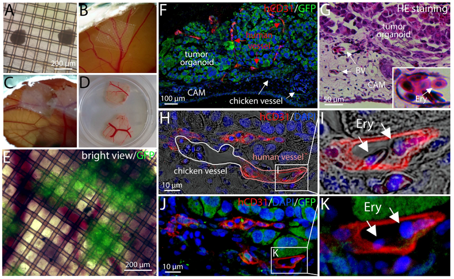 organoidscience's tweet photo. In @SciReports! Generation of complex human #organoid models including vascular networks by incorporation of mesodermal progenitor cells. https://t.co/W6o7e1XWGU https://t.co/GkDtFdiMhc