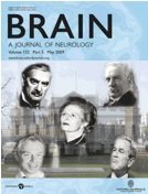 Luisferlup's tweet image. 24)Este es un breve resumen de la información que los expertos en neurología se han encargado de investigar, anexo el enlace de mi fuente principal para que cada lector saque sus propias conclusiones.
academic.oup.com/brain/article/…
Brain, Volume 132
#México #Science #BrainJournal #López