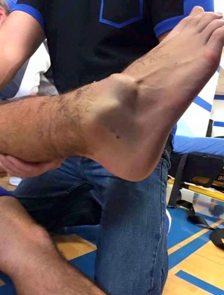 BetParkO's tweet photo. Andre Gomes' injury

*VIEWERS DISCRETION https://t.co/abafvkVFPZ