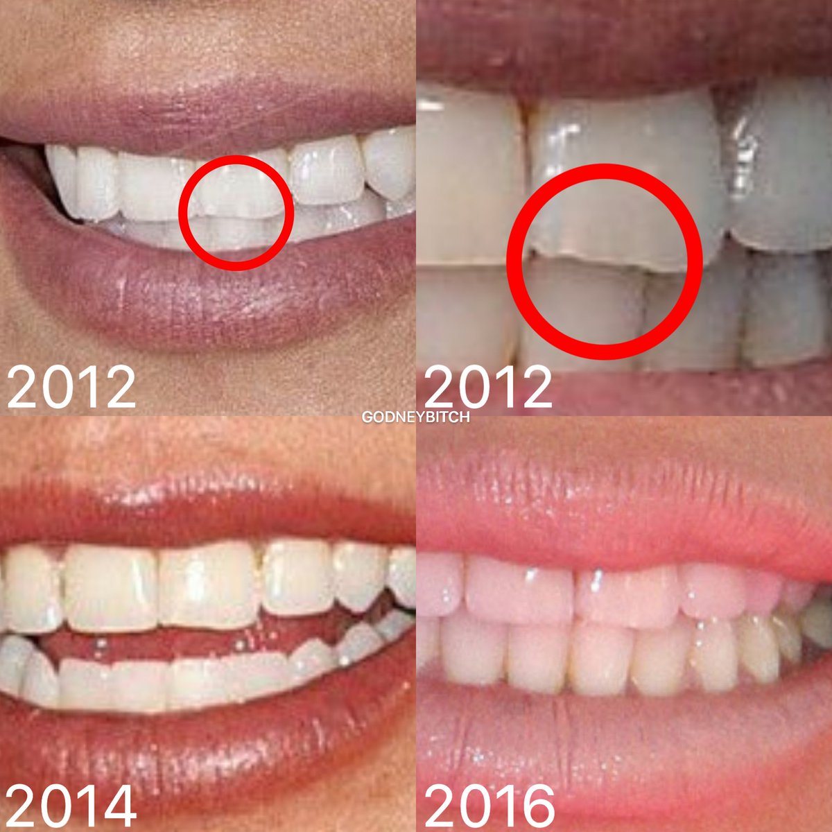 Godney Stan On Twitter One Of Britney S Teeth Has A Special Shape Idk How To Explain Just Look At The Pic So You Can Understand It
