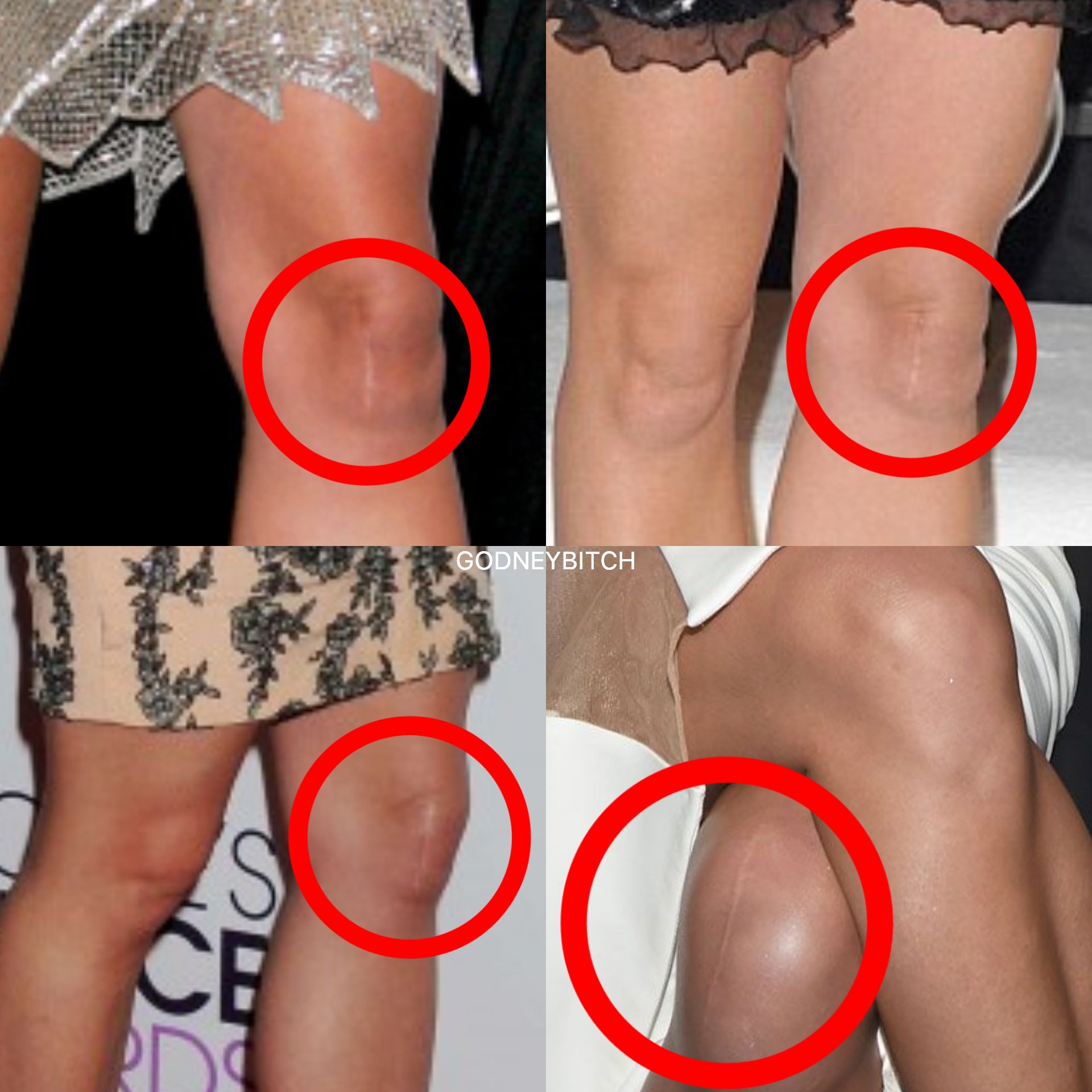 It S Godney Bitch No Twitter Proof That Britney Spears Is Not A Clone Thread Freebritney Britneyspears T Co Dfnfpicjt9 Twitter