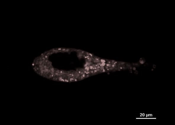 A stark look at #cancerresesearch on #MonochoromeMonday. IraZolve-L1, a lipid targeted #fluorophore for #microscopy on prostate cancer cells.  Published studies identify lipid profile abnormalities in cancer affected cells. Easy to see with ReZolve rezolvescientific.com