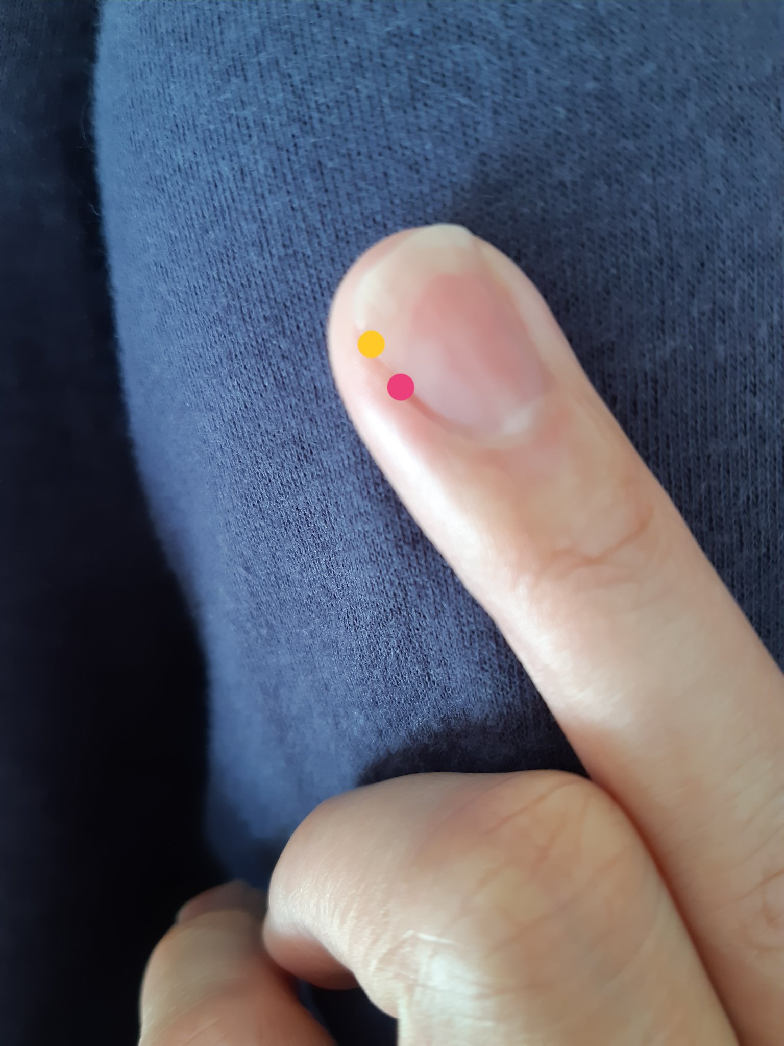 Nobu わたしの薬指 爪の白い部分は 黄色の点までなんだけど その下のピンクの点のところにもう一つラインがある 黄色の点とピンクの点の間はどんな状態 ヤバいのか 良いのか わかる方 助言をください T Co 7xp19swlf1 Twitter