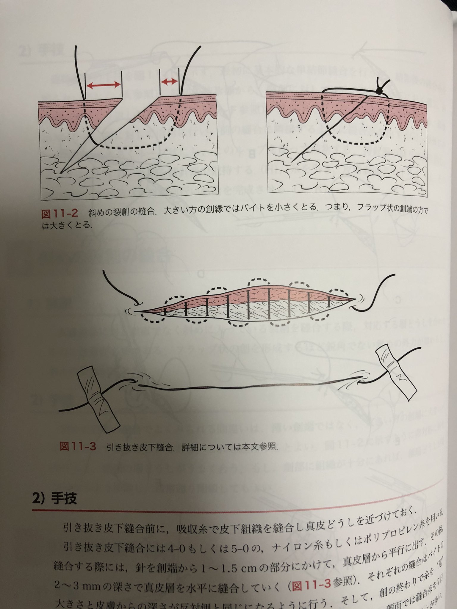 激安大特価！】 ERでの創処置 縫合 治療のスタンダード