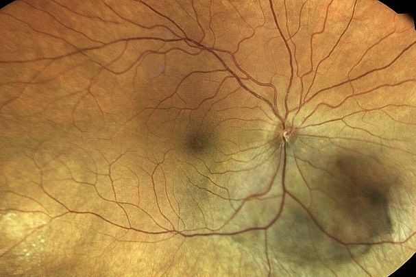 CENTERVUE tweet media