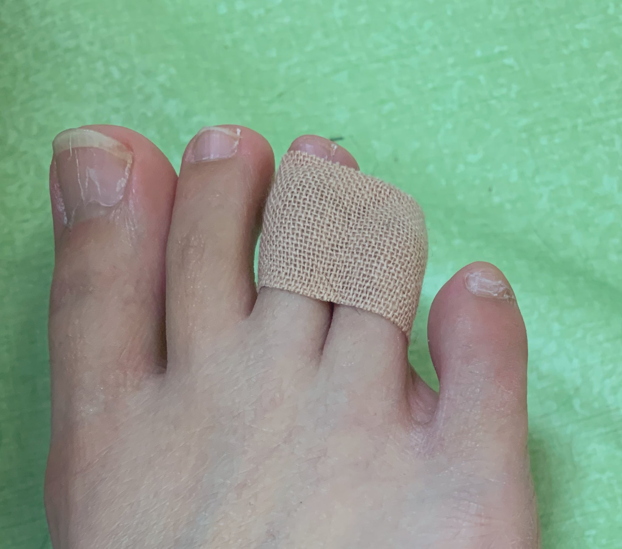 なかせひな ヒール履いて足痛いなーってなる前にすごい痛くならない 方法色々試してコレが一番いい 中指と薬指をテーピングでクルクルと固定すると 痛かったヒールが痛くなーい 無敵な気がする ヒール痛い ハイヒール T Co Ibrpd395rh