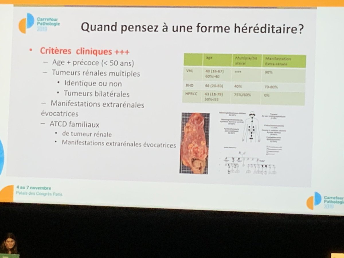 cllaboisse's tweet image. Quand le #pathologiste joue un rôle clef dans l'identification des syndromes de prédisposition héréditaire aus tumeurs du #rein #carrefourpathologie2019