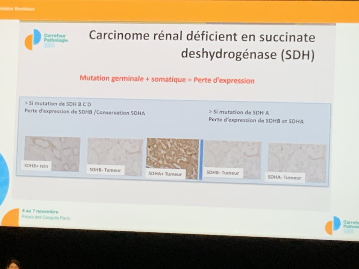 cllaboisse's tweet image. Quand le #pathologiste joue un rôle clef dans l'identification des syndromes de prédisposition héréditaire aus tumeurs du #rein #carrefourpathologie2019
