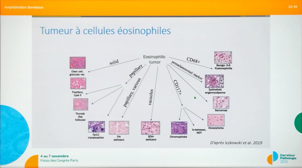Annpathol's tweet image. "Classification of renal tumors : diagnostic algorithms" by Dr Sophie Ferlicot