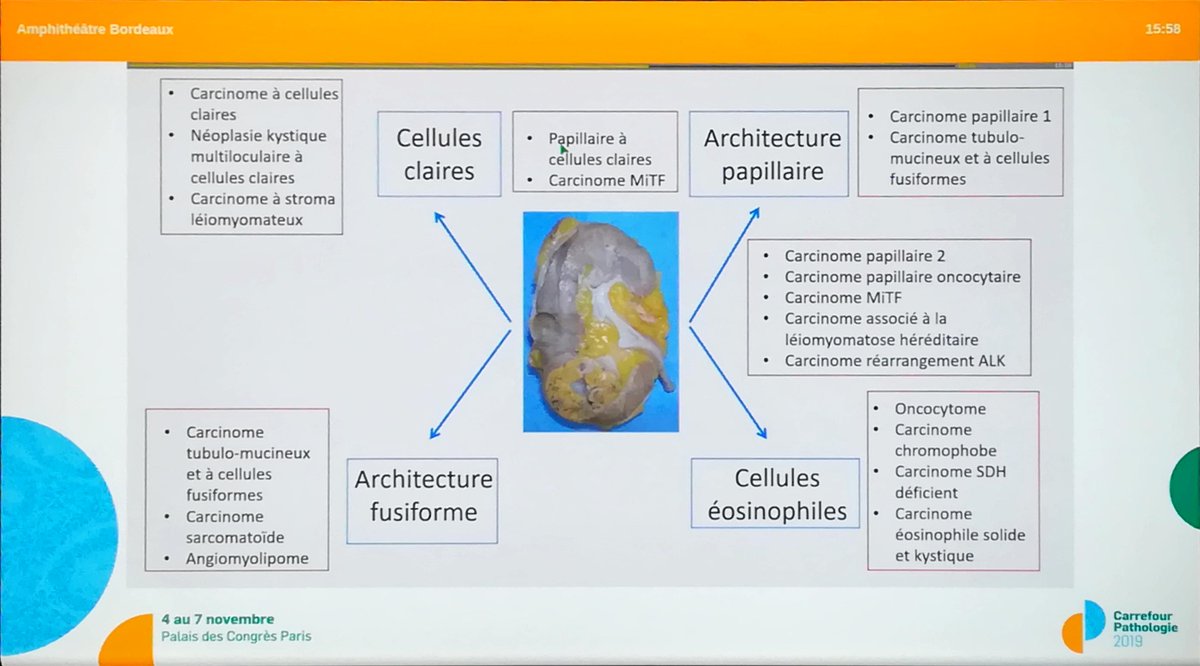 Annpathol's tweet image. "Classification of renal tumors : diagnostic algorithms" by Dr Sophie Ferlicot