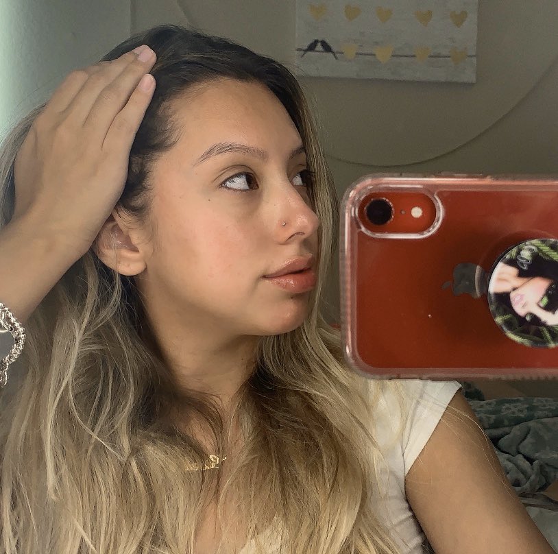 lopezgiselle55's tweet image. 5 months ago I i struggled with cystic acne , I was in so much pain I couldn’t touch my face ! I couldn’t even put make up on . I would cry everyday of how ugly I felt but thank you Accutane for this amazing journey I can finally say I’m a new me .