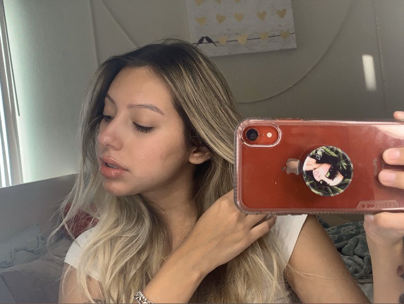 lopezgiselle55's tweet image. 5 months ago I i struggled with cystic acne , I was in so much pain I couldn’t touch my face ! I couldn’t even put make up on . I would cry everyday of how ugly I felt but thank you Accutane for this amazing journey I can finally say I’m a new me .