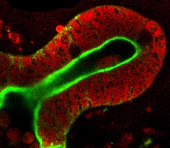 High Content Screening with Fluorescent Probes - mailchi.mp/rezolvescienti…