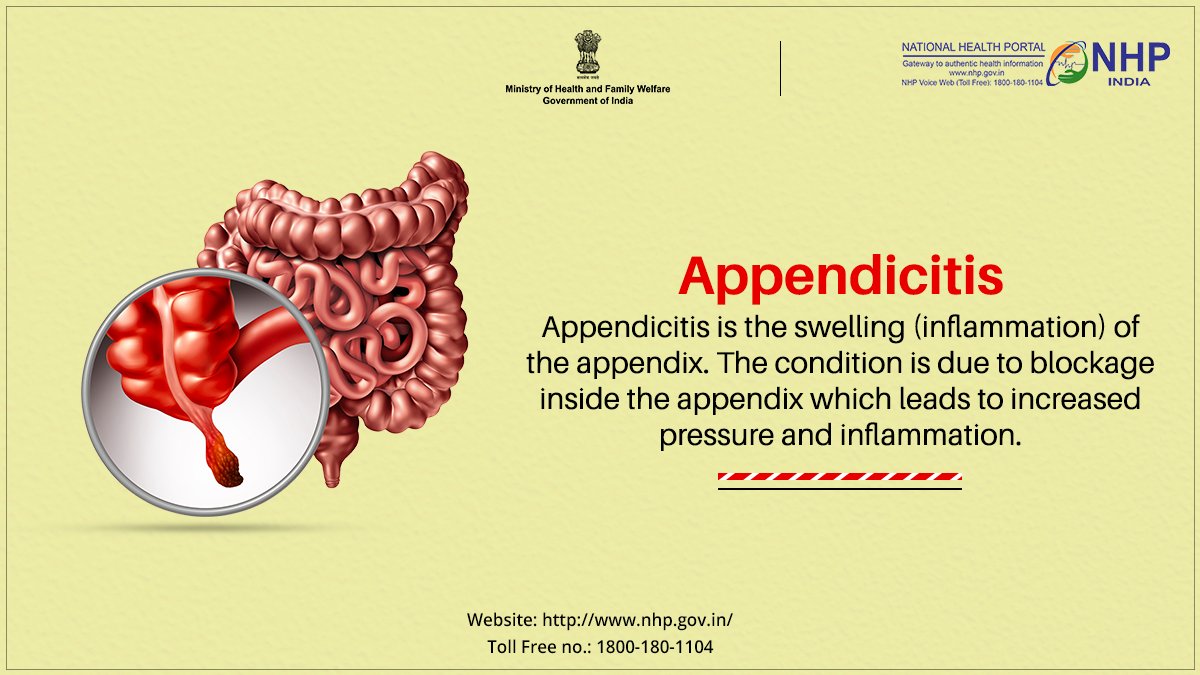 Inside Real Human Ipendix