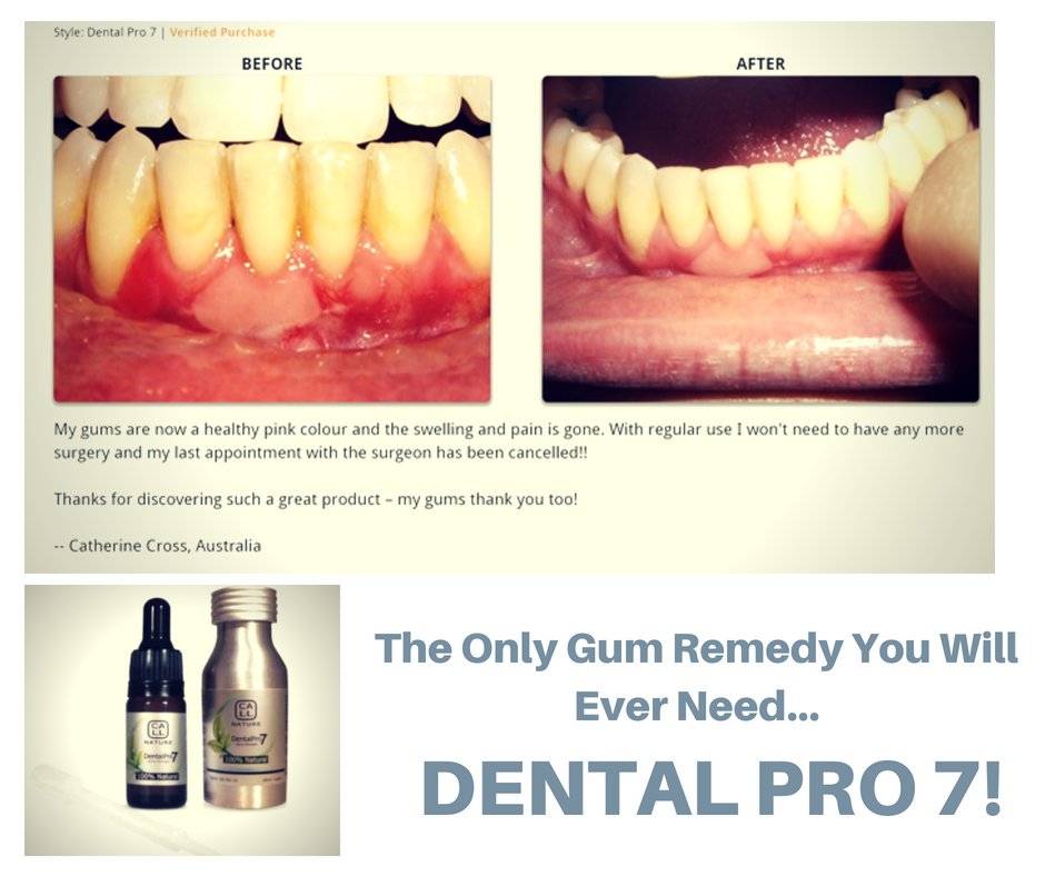 Dental Pro 7 is professional strength 'as standard' (on average 400%-800% more concentrated than commercial brands) so it 'Actually Works' for you as advertised