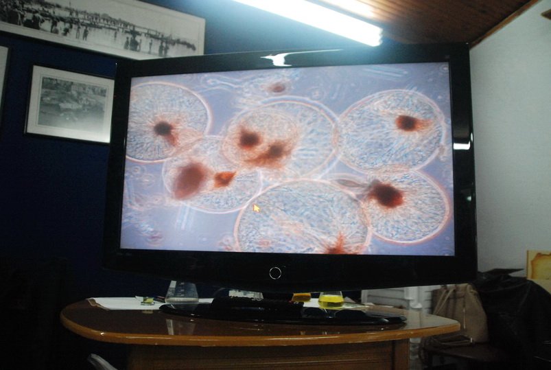 Axios_Delta's tweet image. «Η ζωή σε μια σταγόνα Θερμαϊκού»! Μικροοργανισμοί, βακτήρια, είδη-εισβολείς, τα είδαμε μέσα από το ερευνητικό μικροσκόπιο του #ΑΠΘ. Στη φωτό ο noctiluca που προκαλεί κατά 90% το φαινόμενο της ερυθράς παλίρροιας.
bit.ly/2pyGuSg