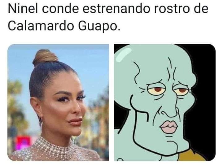 CdIdolos's tweet photo. WTF!!! Hay más plástico en la cara de #NinelConde que en los océanos del planeta 😱 https://t.co/WwklJXmhMT